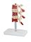 Osteoporosis model for pharmaceutical promotion